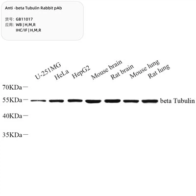 PAB anti-beta tubulină iepure